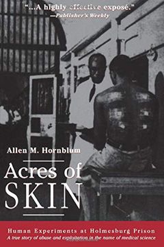 Acres of Skin book cover